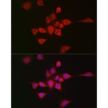 Immunofluorescence - Anti-METTL4 Antibody (A16307) - Antibodies.com