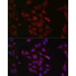 Immunofluorescence - Anti-METTL4 Antibody (A16307) - Antibodies.com