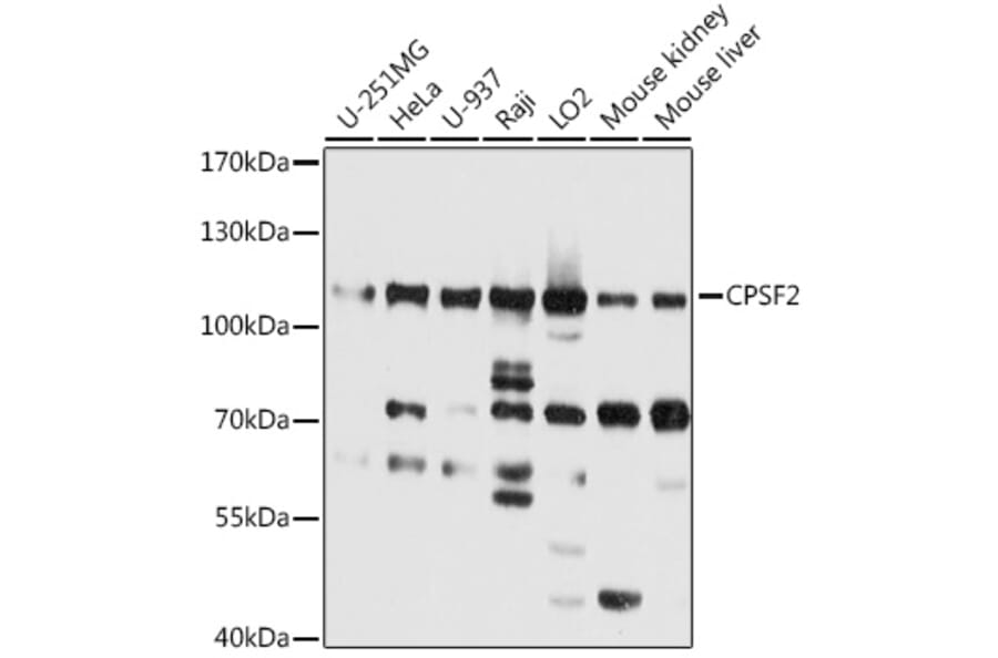 Western Blot - Anti-CPSF2/CPSF100 Antibody (A16308) - Antibodies.com