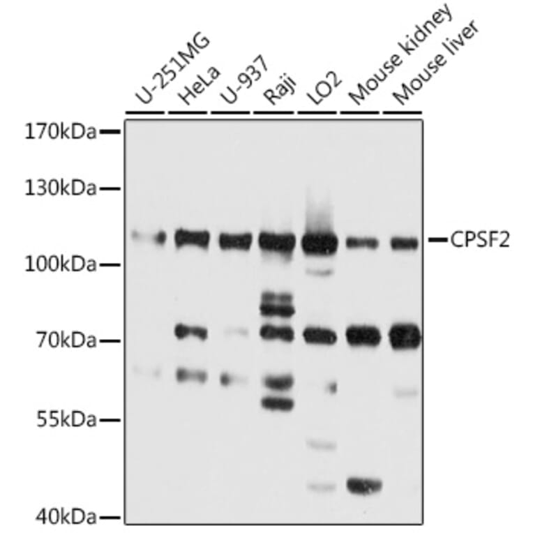 Western Blot - Anti-CPSF2/CPSF100 Antibody (A16308) - Antibodies.com