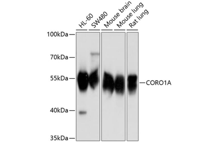 Western Blot - Anti-Coronin 1a/TACO Antibody (A16309) - Antibodies.com