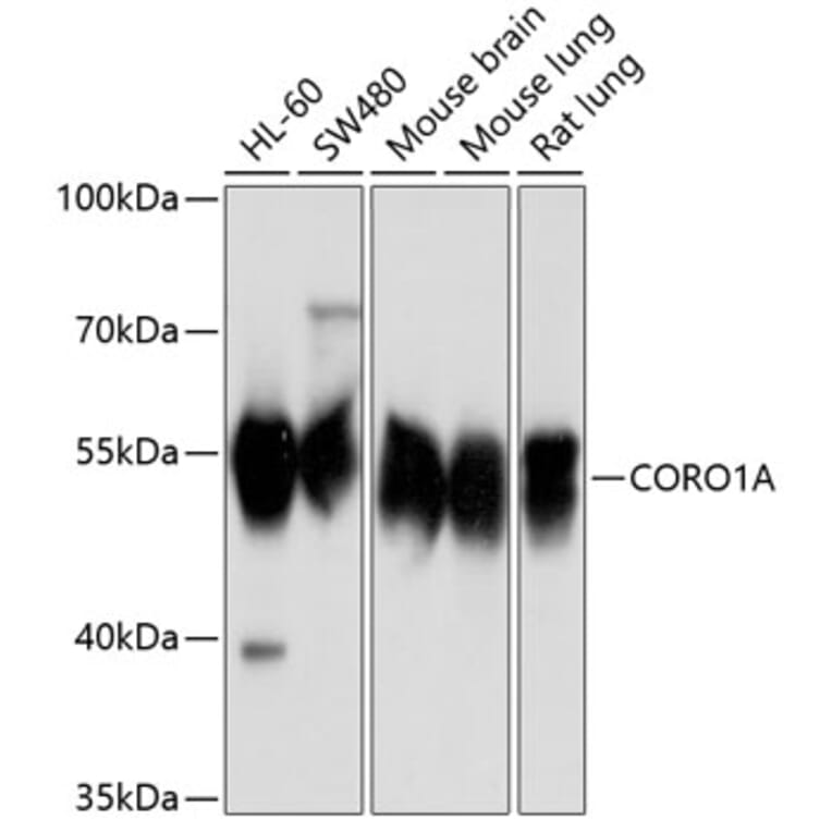 Western Blot - Anti-Coronin 1a/TACO Antibody (A16309) - Antibodies.com