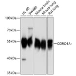 Western Blot - Anti-Coronin 1a/TACO Antibody (A16309) - Antibodies.com