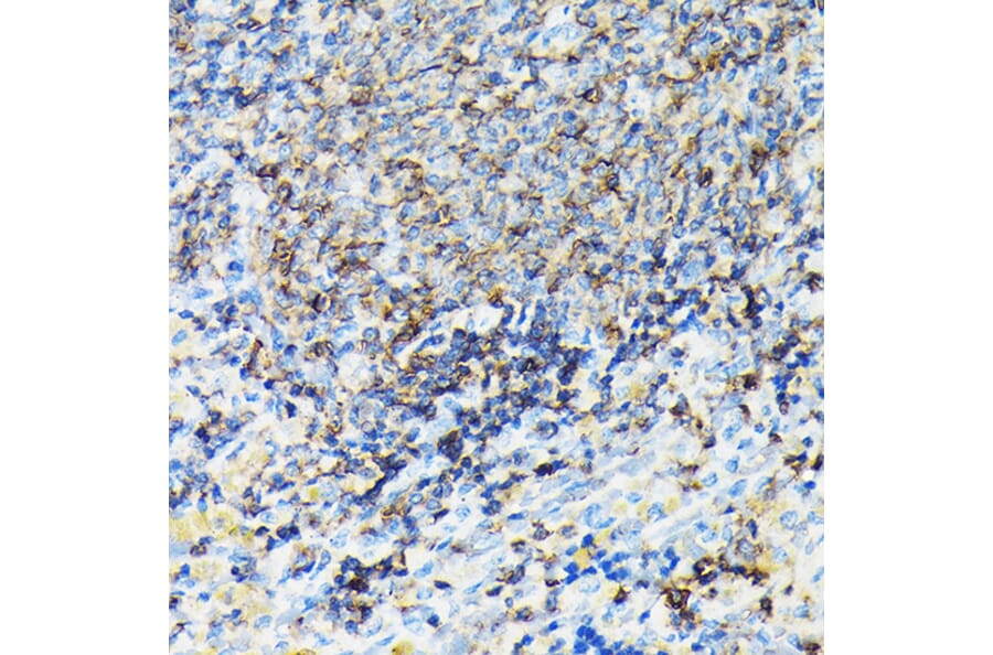 Immunohistochemistry - Anti-Coronin 1a/TACO Antibody (A16309) - Antibodies.com