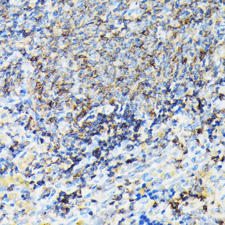 Immunohistochemistry - Anti-Coronin 1a/TACO Antibody (A16309) - Antibodies.com
