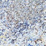 Immunohistochemistry - Anti-Coronin 1a/TACO Antibody (A16309) - Antibodies.com