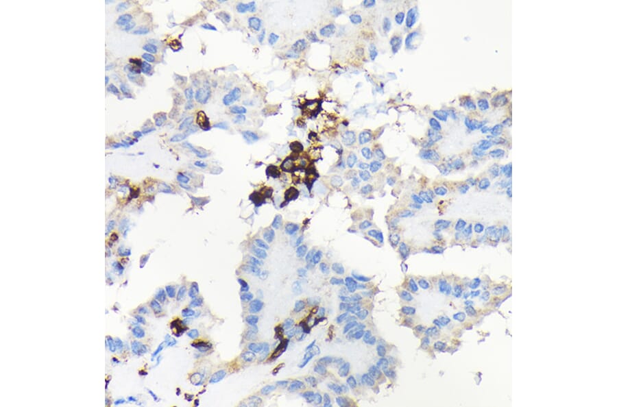 Immunohistochemistry - Anti-Coronin 1a/TACO Antibody (A16309) - Antibodies.com