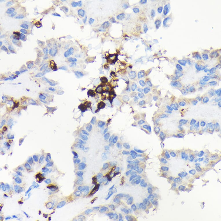 Immunohistochemistry - Anti-Coronin 1a/TACO Antibody (A16309) - Antibodies.com