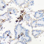 Immunohistochemistry - Anti-Coronin 1a/TACO Antibody (A16309) - Antibodies.com