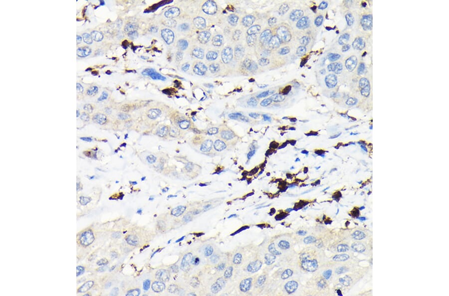 Immunohistochemistry - Anti-Coronin 1a/TACO Antibody (A16309) - Antibodies.com