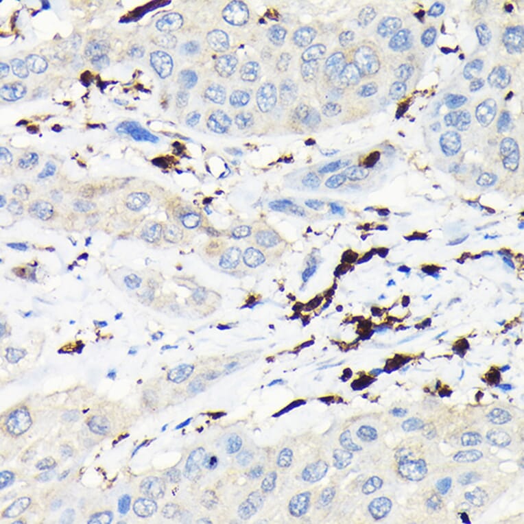 Immunohistochemistry - Anti-Coronin 1a/TACO Antibody (A16309) - Antibodies.com