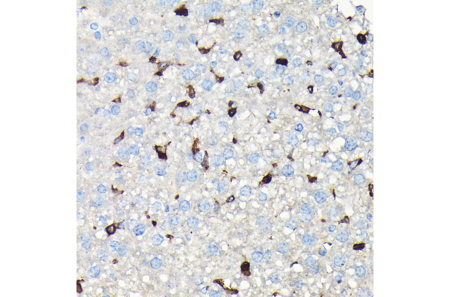Immunohistochemistry - Anti-Coronin 1a/TACO Antibody (A16309) - Antibodies.com
