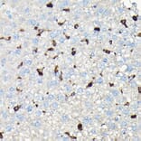 Immunohistochemistry - Anti-Coronin 1a/TACO Antibody (A16309) - Antibodies.com