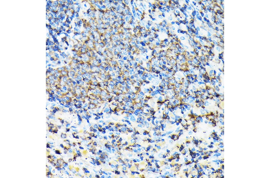 Immunohistochemistry - Anti-Coronin 1a/TACO Antibody (A16309) - Antibodies.com