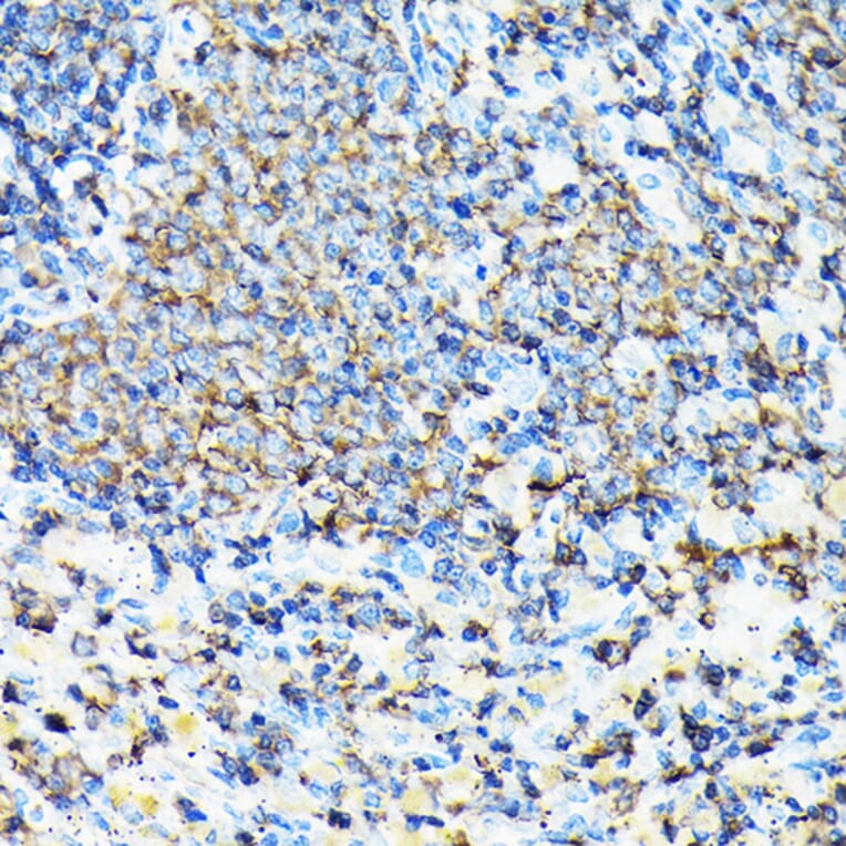 Immunohistochemistry - Anti-Coronin 1a/TACO Antibody (A16309) - Antibodies.com