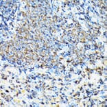 Immunohistochemistry - Anti-Coronin 1a/TACO Antibody (A16309) - Antibodies.com