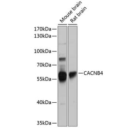 Western Blot - Anti-CACNB4 Antibody (A16310) - Antibodies.com