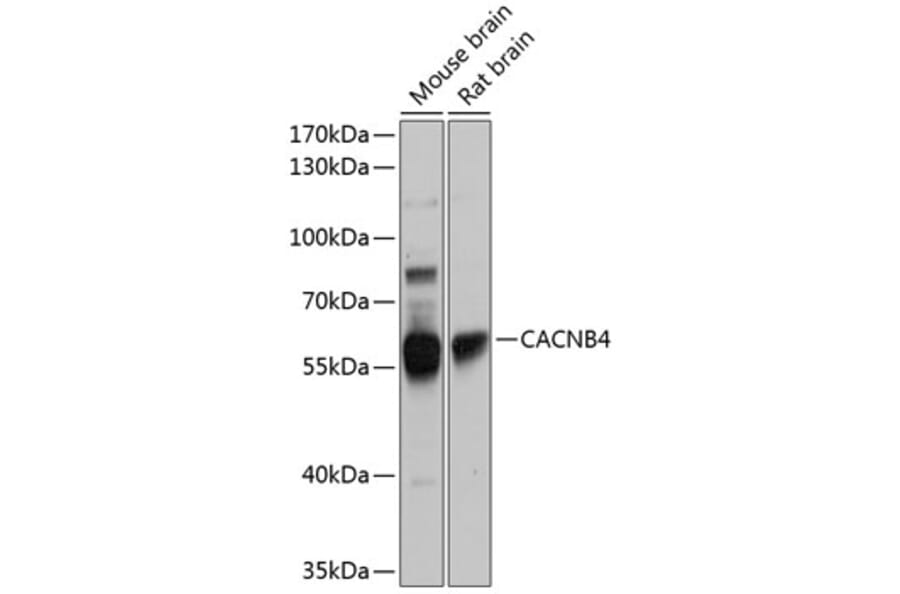 Western Blot - Anti-CACNB4 Antibody (A16310) - Antibodies.com
