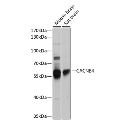 Western Blot - Anti-CACNB4 Antibody (A16310) - Antibodies.com