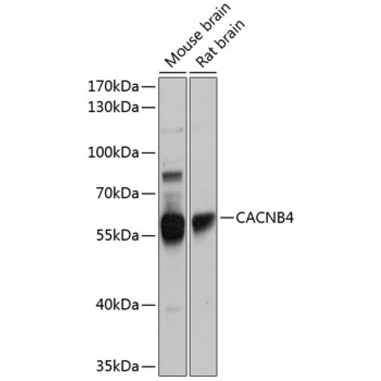 Western Blot - Anti-CACNB4 Antibody (A16310) - Antibodies.com