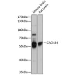 Western Blot - Anti-CACNB4 Antibody (A16310) - Antibodies.com