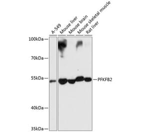 Western Blot - Anti-PFKFB2 Antibody (A16311) - Antibodies.com