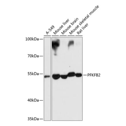 Western Blot - Anti-PFKFB2 Antibody (A16311) - Antibodies.com