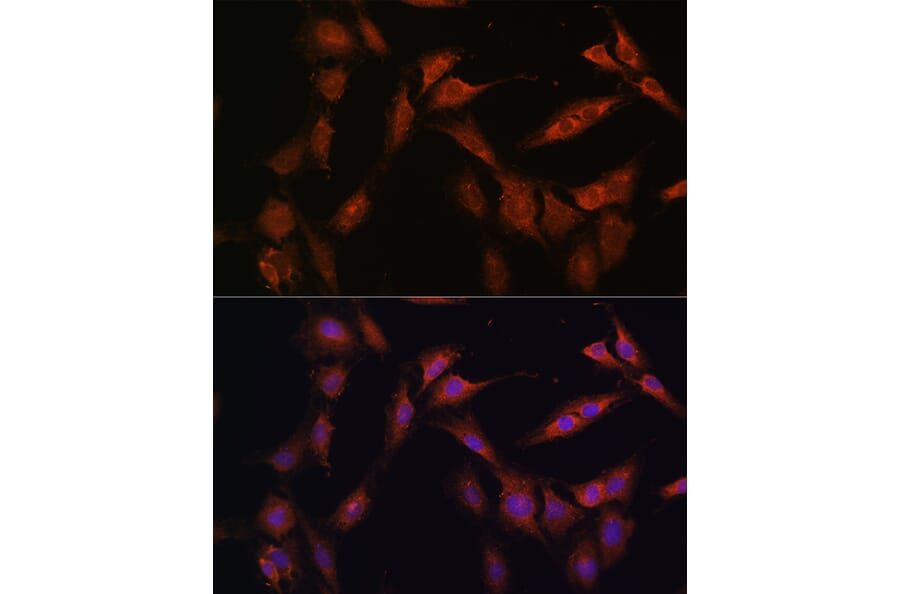Immunofluorescence - Anti-PFKFB2 Antibody (A16311) - Antibodies.com