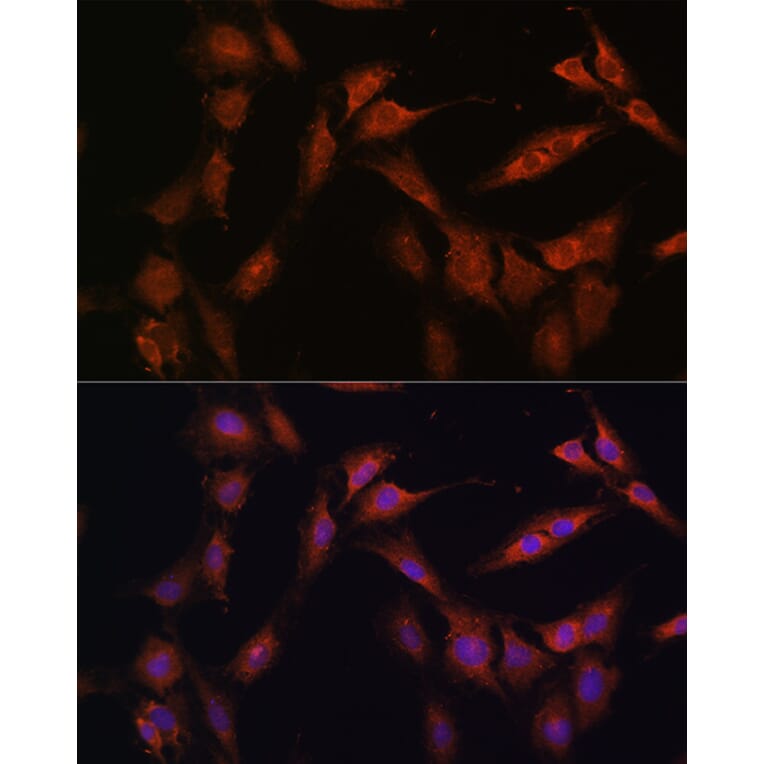 Immunofluorescence - Anti-PFKFB2 Antibody (A16311) - Antibodies.com