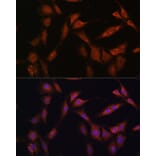 Immunofluorescence - Anti-PFKFB2 Antibody (A16311) - Antibodies.com