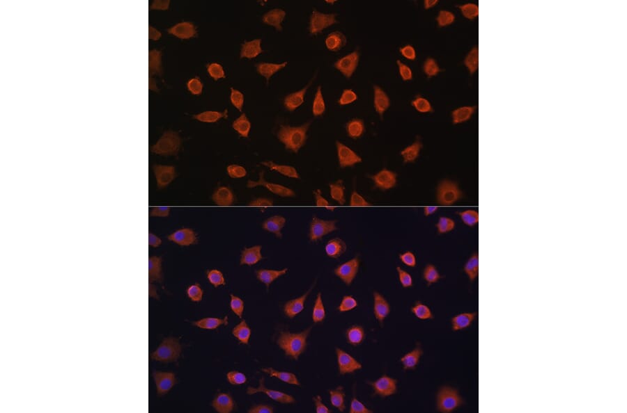 Immunofluorescence - Anti-PFKFB2 Antibody (A16311) - Antibodies.com