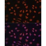 Immunofluorescence - Anti-PFKFB2 Antibody (A16311) - Antibodies.com