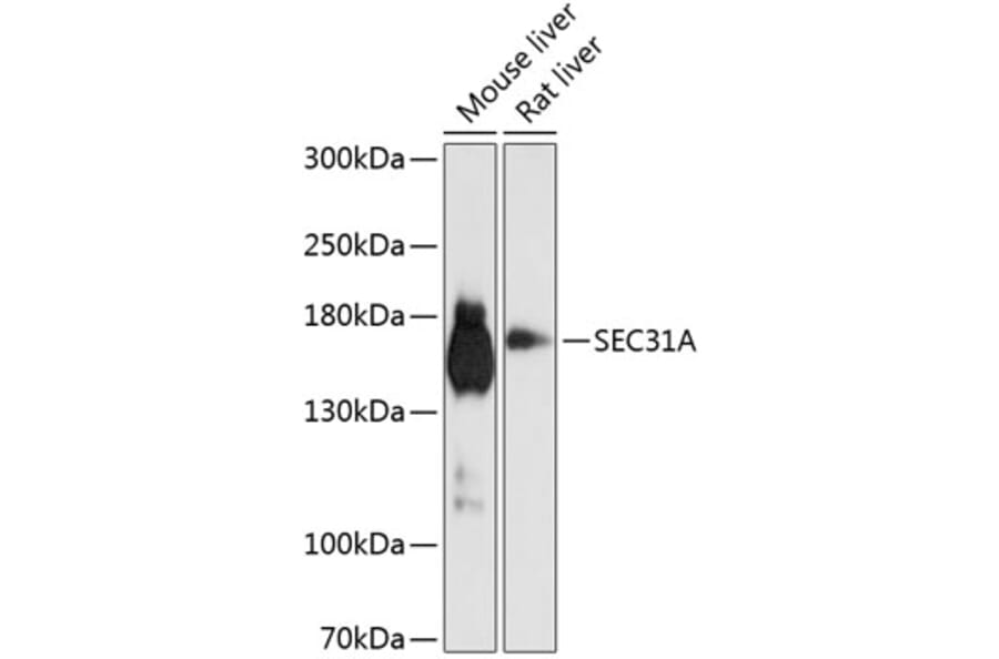Western Blot - Anti-Sec31A Antibody (A16312) - Antibodies.com