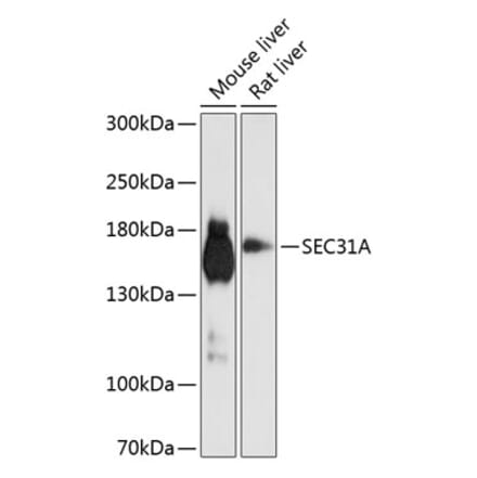 Western Blot - Anti-Sec31A Antibody (A16312) - Antibodies.com