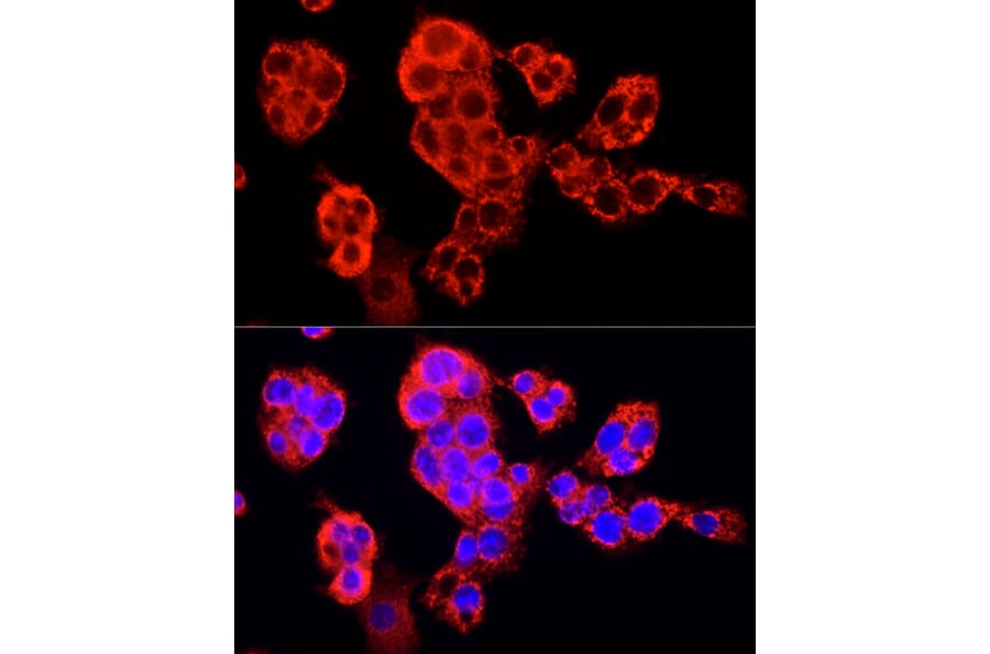 Immunofluorescence - Anti-Sec31A Antibody (A16312) - Antibodies.com
