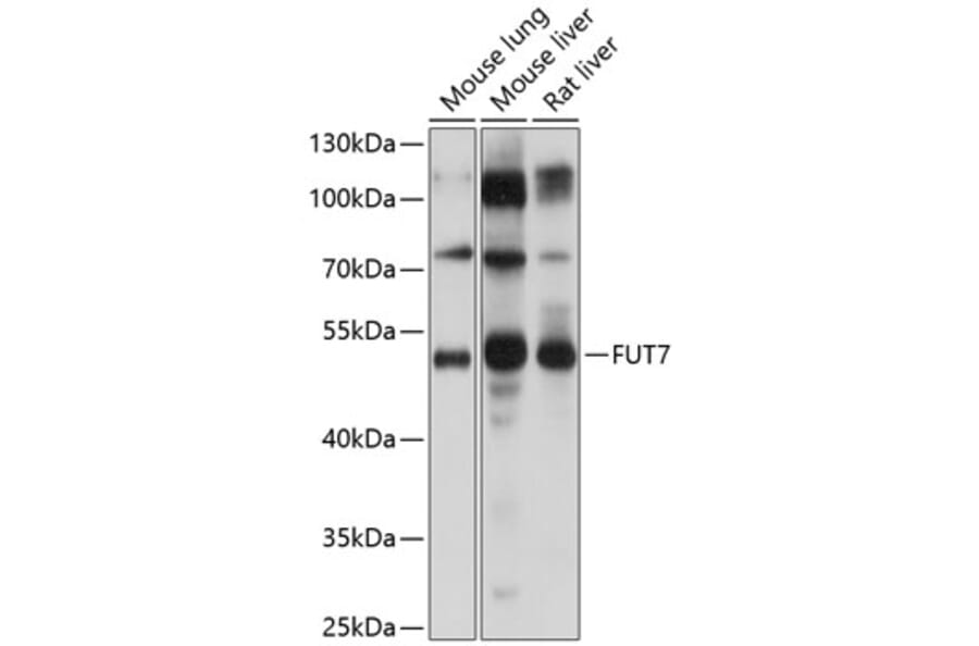 Western Blot - Anti-FUT4 Antibody (A16313) - Antibodies.com