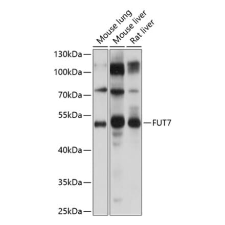 Western Blot - Anti-FUT4 Antibody (A16313) - Antibodies.com