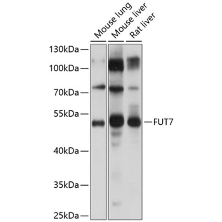 Western Blot - Anti-FUT4 Antibody (A16313) - Antibodies.com