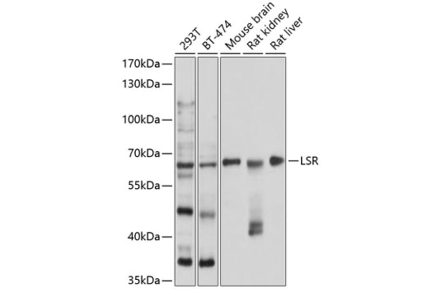 Western Blot - Anti-LSR Antibody (A16314) - Antibodies.com