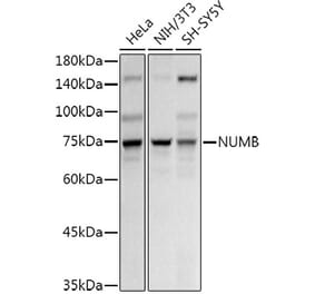 Western Blot - Anti-NUMB Antibody (A16316) - Antibodies.com