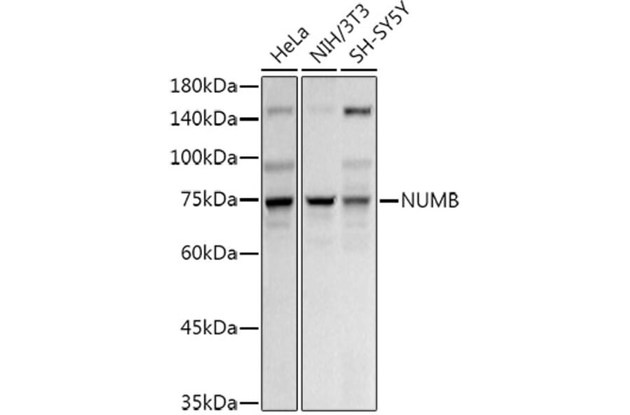 Western Blot - Anti-NUMB Antibody (A16316) - Antibodies.com