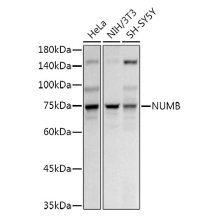 Western Blot - Anti-NUMB Antibody (A16316) - Antibodies.com