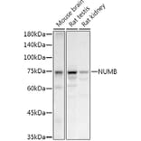 Western Blot - Anti-NUMB Antibody (A16316) - Antibodies.com