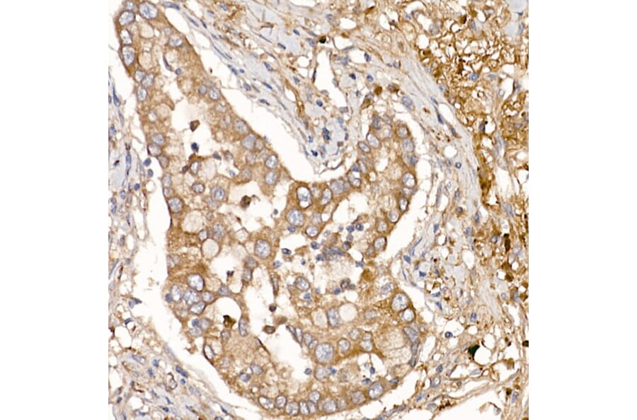 Immunohistochemistry - Anti-NUMB Antibody (A16316) - Antibodies.com