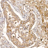 Immunohistochemistry - Anti-NUMB Antibody (A16316) - Antibodies.com