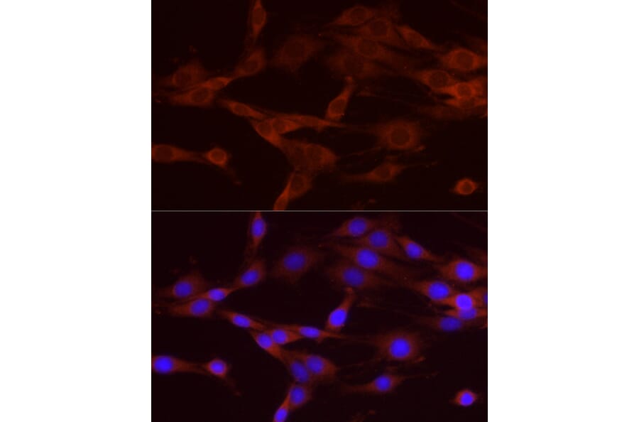 Immunofluorescence - Anti-NUMB Antibody (A16316) - Antibodies.com
