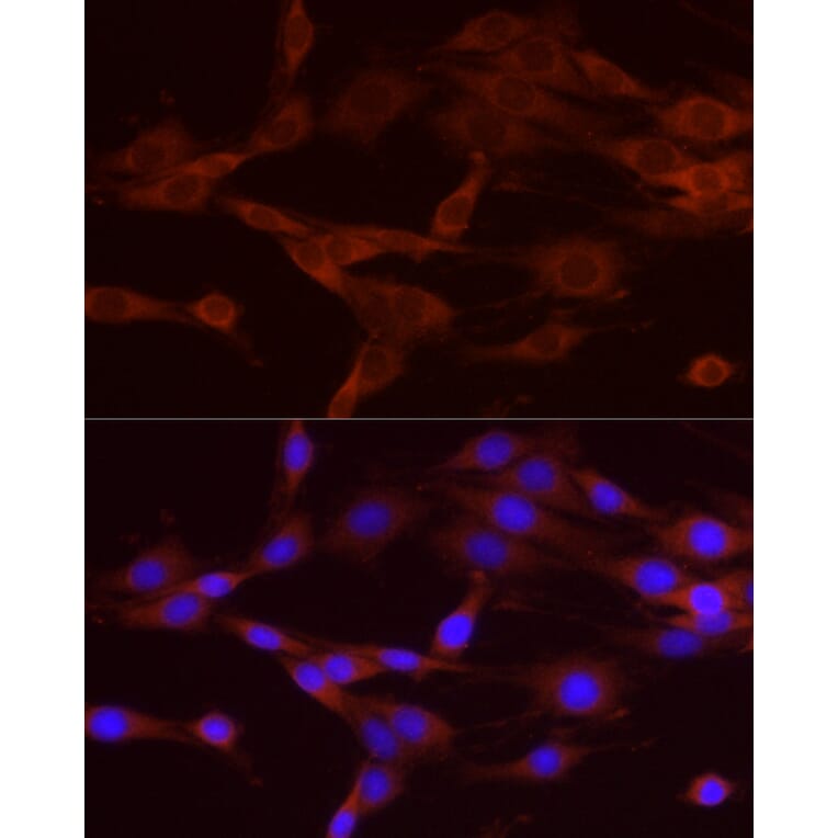 Immunofluorescence - Anti-NUMB Antibody (A16316) - Antibodies.com