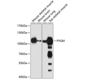 Western Blot - Anti-PYGM Antibody (A16317) - Antibodies.com