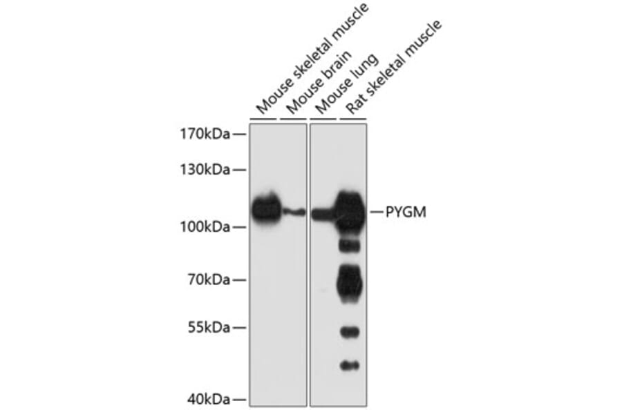 Western Blot - Anti-PYGM Antibody (A16317) - Antibodies.com
