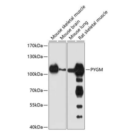 Western Blot - Anti-PYGM Antibody (A16317) - Antibodies.com